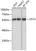Anti-CD1a antibody used in Western Blot (WB). GTX32500