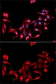 Anti-CD42a antibody used in Immunocytochemistry/ Immunofluorescence (ICC/IF). GTX32502