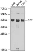 Anti-CD7 antibody used in Western Blot (WB). GTX32505