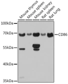 Anti-CD86 antibody used in Western Blot (WB). GTX32507