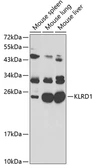 Anti-CD94 antibody used in Western Blot (WB). GTX32509