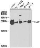 Anti-CD99 antibody used in Western Blot (WB). GTX32510