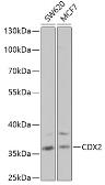 Anti-CDX2 antibody used in Western Blot (WB). GTX32513