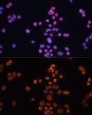 Anti-CDX2 antibody used in Immunocytochemistry/ Immunofluorescence (ICC/IF). GTX32513