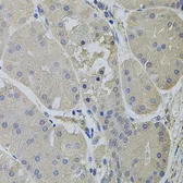 Anti-Clathrin Heavy chain antibody used in IHC (Paraffin sections) (IHC-P). GTX32526