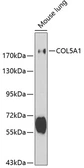 Anti-COL5A1 antibody used in Western Blot (WB). GTX32530