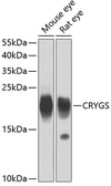 Anti-Beta crystallin S antibody used in Western Blot (WB). GTX32540