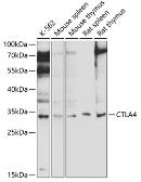 Anti-CTLA4 antibody used in Western Blot (WB). GTX32542