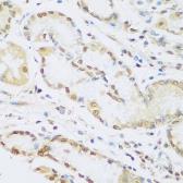 Anti-Cyclin D2 antibody used in IHC (Paraffin sections) (IHC-P). GTX32545