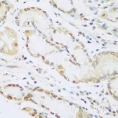 Anti-Cyclin D2 antibody used in IHC (Paraffin sections) (IHC-P). GTX32545