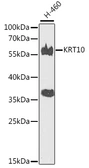 Anti-Cytokeratin 10 antibody used in Western Blot (WB). GTX32547