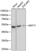 Anti-Cytokeratin 17 antibody used in Western Blot (WB). GTX32548