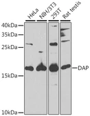 Anti-DAP1 antibody used in Western Blot (WB). GTX32550