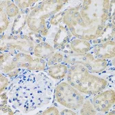 Anti-DCP2 antibody used in IHC (Paraffin sections) (IHC-P). GTX32554