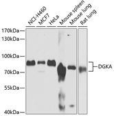 Anti-DGKA antibody used in Western Blot (WB). GTX32558
