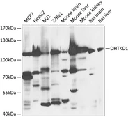Anti-DHTKD1 antibody used in Western Blot (WB). GTX32561