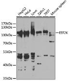 Anti-eEF2K antibody used in Western Blot (WB). GTX32573