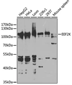 Anti-eEF2K antibody used in Western Blot (WB). GTX32573