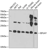 Anti-EIF1A antibody used in Western Blot (WB). GTX32576