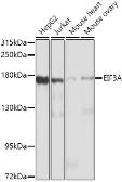 Anti-EIF3A antibody used in Western Blot (WB). GTX32578