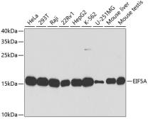 Anti-EIF5A antibody used in Western Blot (WB). GTX32581