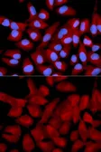 Anti-EIF5A antibody used in Immunocytochemistry/ Immunofluorescence (ICC/IF). GTX32581