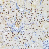 Anti-ELAC2 antibody used in IHC (Paraffin sections) (IHC-P). GTX32582