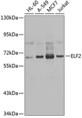 Anti-ELF2 antibody used in Western Blot (WB). GTX32584