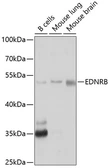 Anti-Endothelin B Receptor antibody used in Western Blot (WB). GTX32585