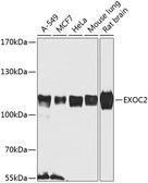 Anti-EXOC2 antibody used in Western Blot (WB). GTX32593