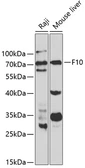 Anti-Factor X antibody used in Western Blot (WB). GTX32595
