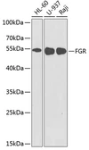 Anti-FGR antibody used in Western Blot (WB). GTX32602