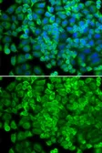 Anti-Galactosidase alpha antibody used in Immunocytochemistry/ Immunofluorescence (ICC/IF). GTX32617