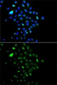 Anti-gamma Catenin antibody used in Immunocytochemistry/ Immunofluorescence (ICC/IF). GTX32619