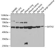 Anti-GATA2 antibody used in Western Blot (WB). GTX32620