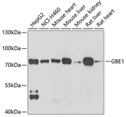 Anti-GBE1 antibody used in Western Blot (WB). GTX32621