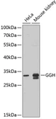 Anti-Glutamyl hydrolase gamma antibody used in Western Blot (WB). GTX32628