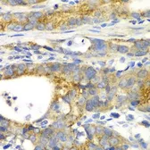 Anti-GRASP65 antibody used in IHC (Paraffin sections) (IHC-P). GTX32631