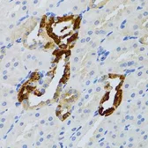 Anti-GRB2 antibody used in IHC (Paraffin sections) (IHC-P). GTX32632