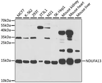 Anti-GRIM19 antibody used in Western Blot (WB). GTX32634