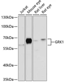 Anti-GRK1 antibody used in Western Blot (WB). GTX32635