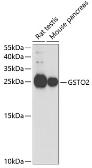 Anti-GSTO2 antibody used in Western Blot (WB). GTX32638