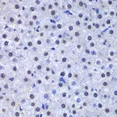 Anti-GSTP1 antibody used in IHC (Paraffin sections) (IHC-P). GTX32639