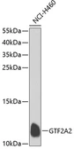 Anti-GTF2A2 antibody used in Western Blot (WB). GTX32640
