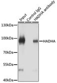 Anti-HADHA antibody used in Immunoprecipitation (IP). GTX32642