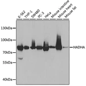 Anti-HADHA antibody used in Western Blot (WB). GTX32642