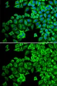 Anti-HCK antibody used in Immunocytochemistry/ Immunofluorescence (ICC/IF). GTX32645