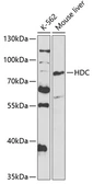 Anti-HDC antibody used in Western Blot (WB). GTX32647