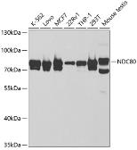 Anti-Hec1 antibody used in Western Blot (WB). GTX32648