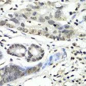 Anti-HIF1AN antibody used in IHC (Paraffin sections) (IHC-P). GTX32652